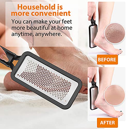 MAYCREATE® Leg Heel Foot Scrubber for Dead Skin Stainless Steel Exfoliating Cleaner File Callus Remover for Cracked Heels Pedicure Kit Very Sharp Big 11 x 3 inch 3PCS MAYCREATE® Leg Heel Foot Scrubber for Dead Skin Stainless Steel Exfoliating Cleaner File Callus Remover for Cracked Heels Pedicure Kit Very Sharp Big 11 x 3 inch 3PCS